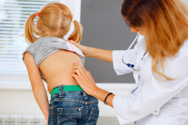 scoliosis physical therapy