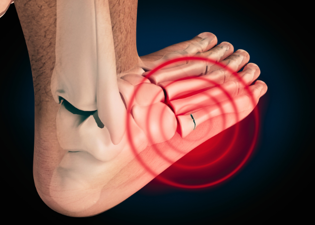 Fifth metatarsal fracture pain in foot: treatments, physical therapy, recovery, tips