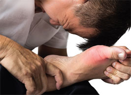 Kick the Pain of Gout